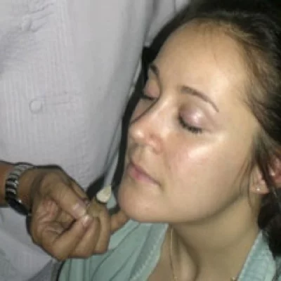 instrument de massage facial - Moxas d’armoise
